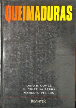 Queimaduras - Dino Gomes