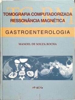 Tomografia Computadorizada, Ressonância Magnética: Gastroenterologia-